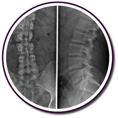 Gonstead X-rays in Daytona Beach